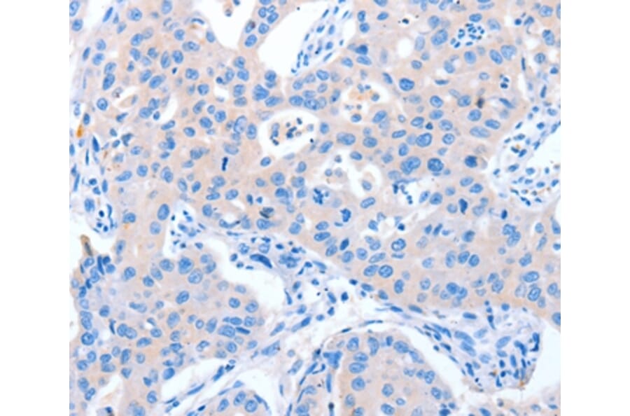 Immunohistochemistry - NUAK1 Antibody from Signalway Antibody (37345) - Antibodies.com