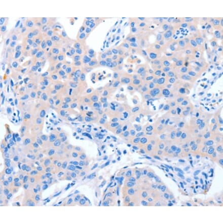 Immunohistochemistry - NUAK1 Antibody from Signalway Antibody (37345) - Antibodies.com