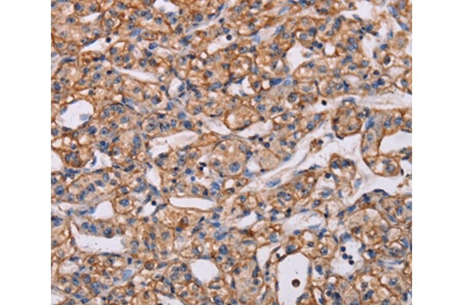 Immunohistochemistry - ARAP1 Antibody from Signalway Antibody (37347) - Antibodies.com