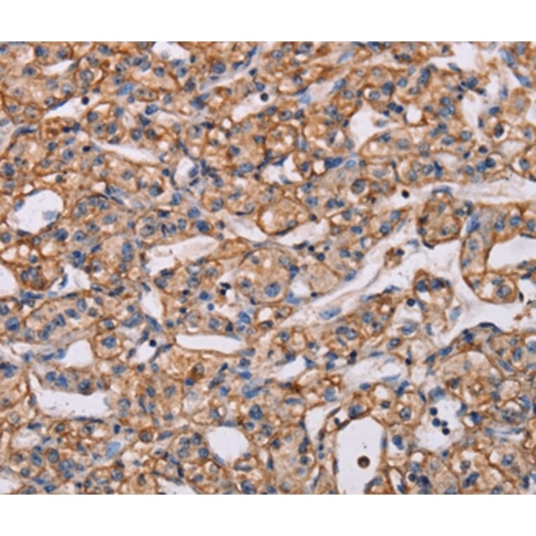 Immunohistochemistry - ARAP1 Antibody from Signalway Antibody (37347) - Antibodies.com