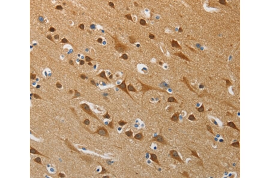 Immunohistochemistry - ATG4B Antibody from Signalway Antibody (37355) - Antibodies.com