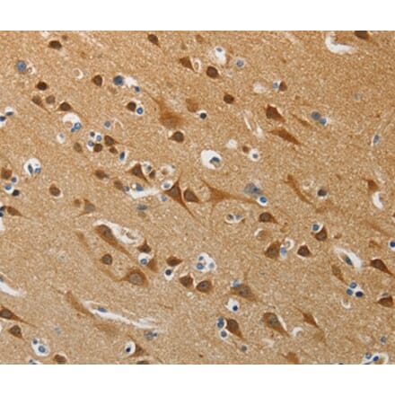 Immunohistochemistry - ATG4B Antibody from Signalway Antibody (37355) - Antibodies.com