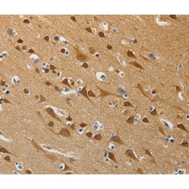 Immunohistochemistry - ATG4B Antibody from Signalway Antibody (37355) - Antibodies.com