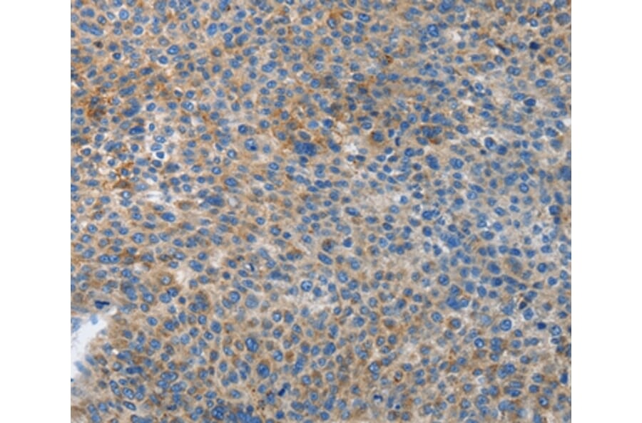 Immunohistochemistry - ATG4B Antibody from Signalway Antibody (37355) - Antibodies.com