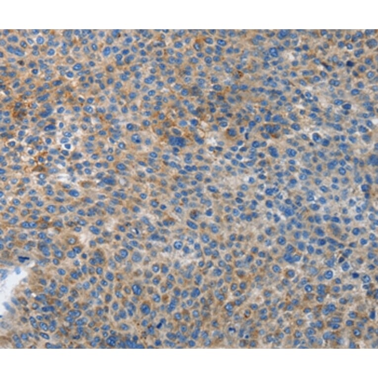 Immunohistochemistry - ATG4B Antibody from Signalway Antibody (37355) - Antibodies.com