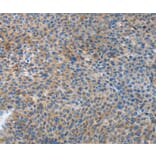 Immunohistochemistry - ATG4B Antibody from Signalway Antibody (37355) - Antibodies.com