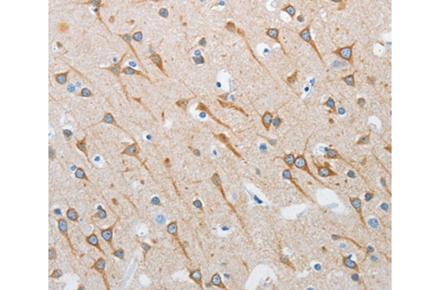 Immunohistochemistry - INTS1 Antibody from Signalway Antibody (37357) - Antibodies.com