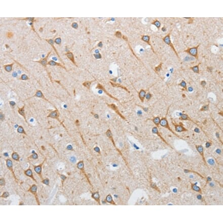 Immunohistochemistry - INTS1 Antibody from Signalway Antibody (37357) - Antibodies.com
