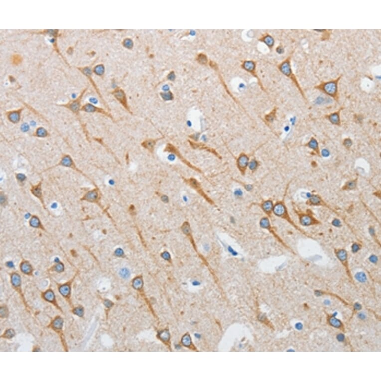 Immunohistochemistry - INTS1 Antibody from Signalway Antibody (37357) - Antibodies.com
