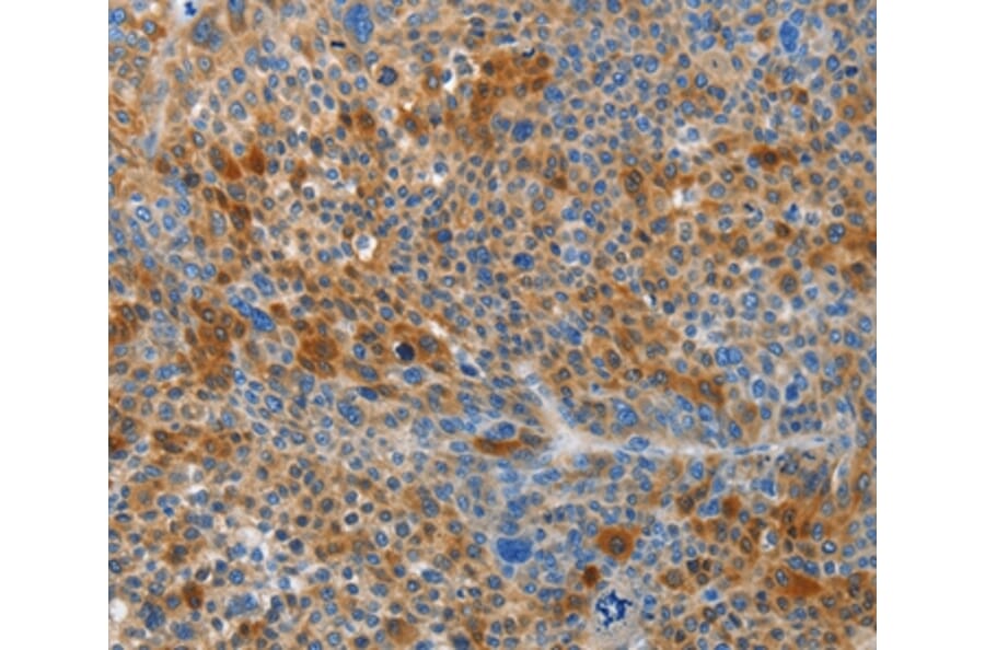Immunohistochemistry - HTRA3 Antibody from Signalway Antibody (37361) - Antibodies.com
