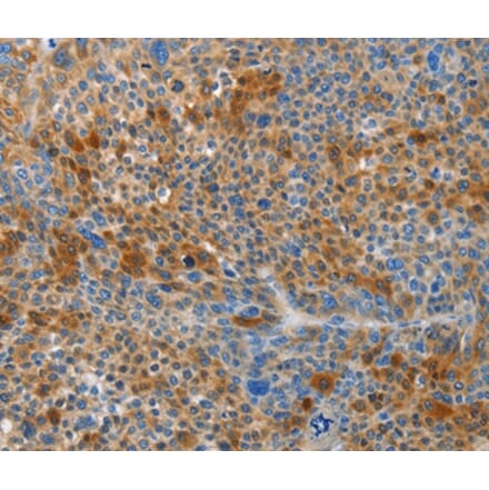 Immunohistochemistry - HTRA3 Antibody from Signalway Antibody (37361) - Antibodies.com