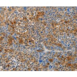 Immunohistochemistry - HTRA3 Antibody from Signalway Antibody (37361) - Antibodies.com