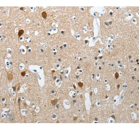 Immunohistochemistry - RCAN2 Antibody from Signalway Antibody (37363) - Antibodies.com