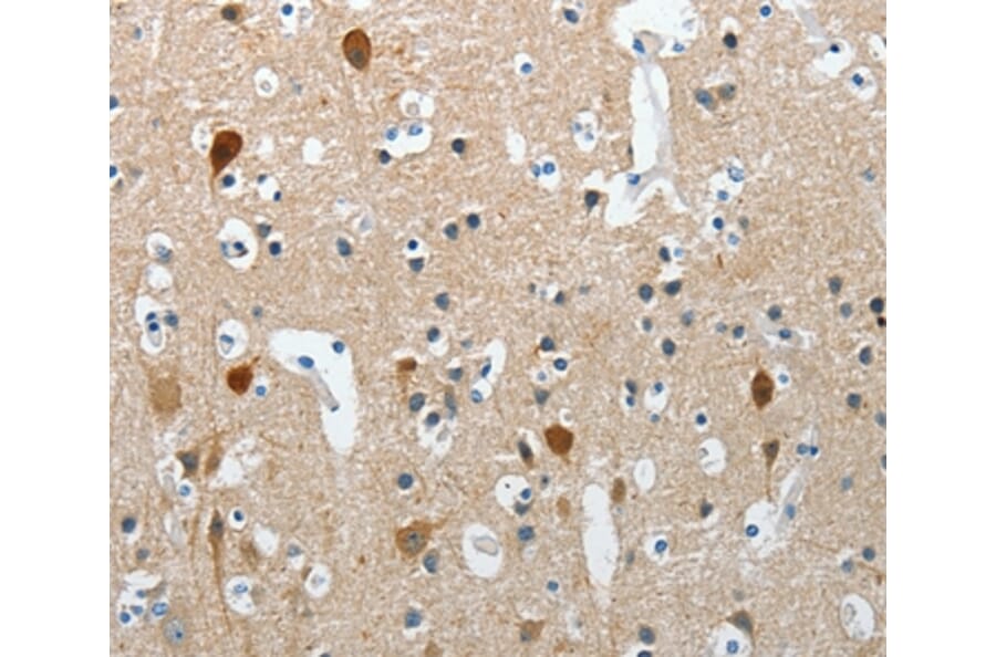 Immunohistochemistry - RCAN2 Antibody from Signalway Antibody (37363) - Antibodies.com