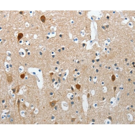 Immunohistochemistry - RCAN2 Antibody from Signalway Antibody (37363) - Antibodies.com