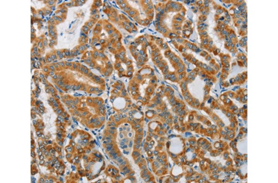 Immunohistochemistry - PITX3 Antibody from Signalway Antibody (37364) - Antibodies.com