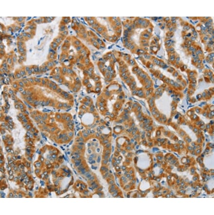 Immunohistochemistry - PITX3 Antibody from Signalway Antibody (37364) - Antibodies.com