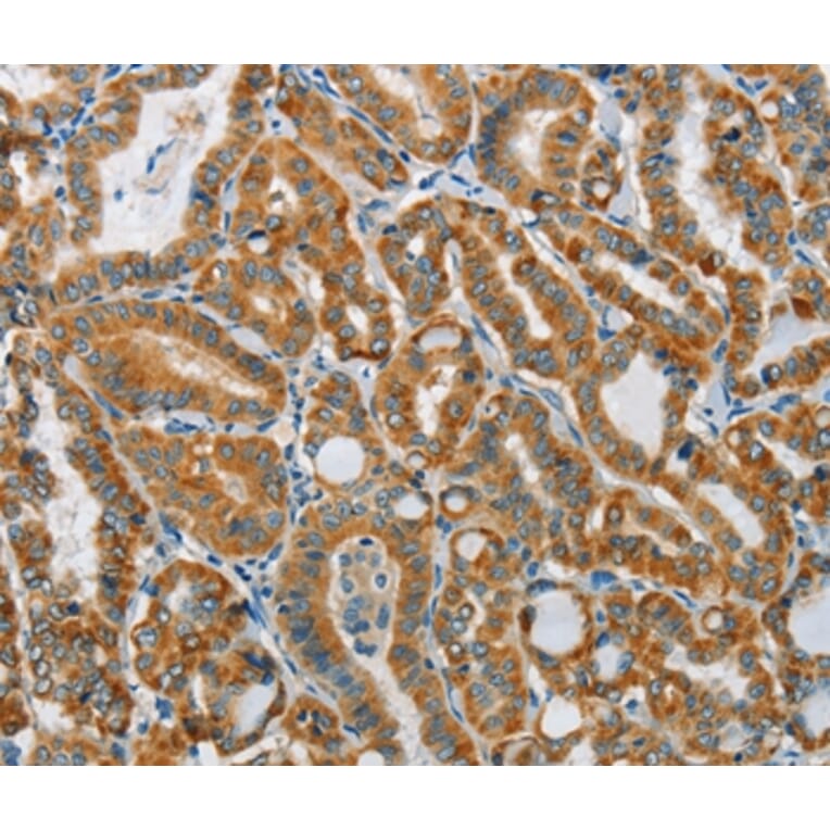 Immunohistochemistry - PITX3 Antibody from Signalway Antibody (37364) - Antibodies.com