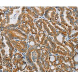 Immunohistochemistry - PITX3 Antibody from Signalway Antibody (37364) - Antibodies.com
