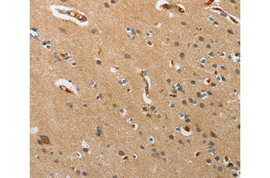 Immunohistochemistry - PITX3 Antibody from Signalway Antibody (37364) - Antibodies.com