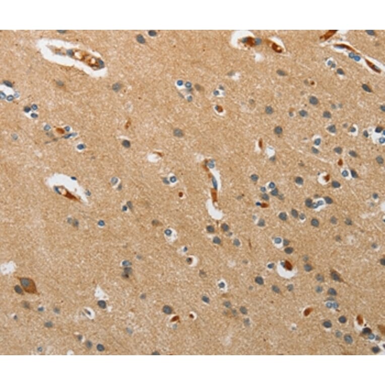 Immunohistochemistry - PITX3 Antibody from Signalway Antibody (37364) - Antibodies.com