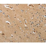 Immunohistochemistry - PITX3 Antibody from Signalway Antibody (37364) - Antibodies.com