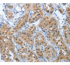 Immunohistochemistry - PFDN6 Antibody from Signalway Antibody (37367) - Antibodies.com