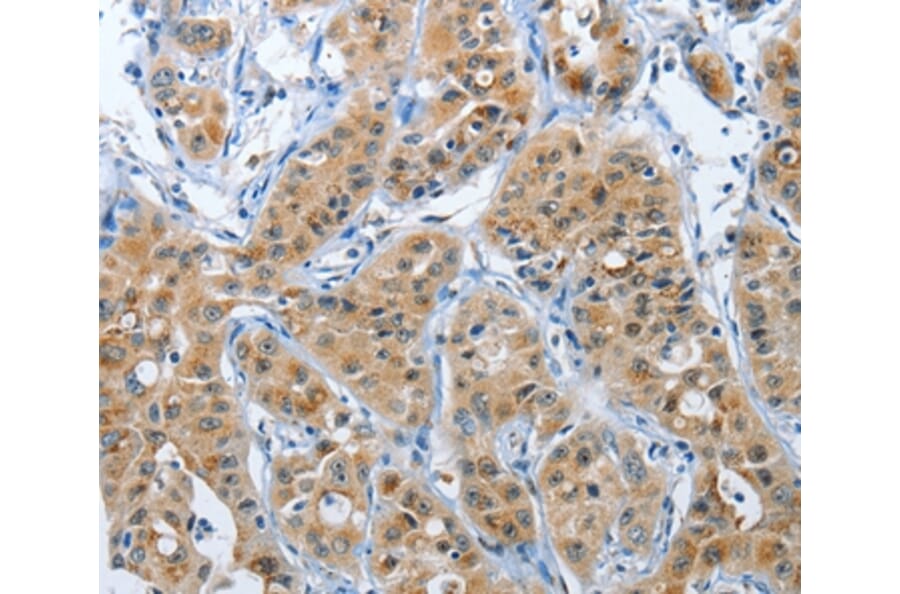 Immunohistochemistry - PFDN6 Antibody from Signalway Antibody (37367) - Antibodies.com