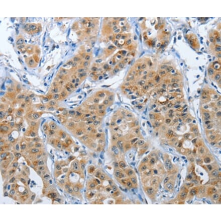 Immunohistochemistry - PFDN6 Antibody from Signalway Antibody (37367) - Antibodies.com