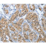 Immunohistochemistry - PFDN6 Antibody from Signalway Antibody (37367) - Antibodies.com