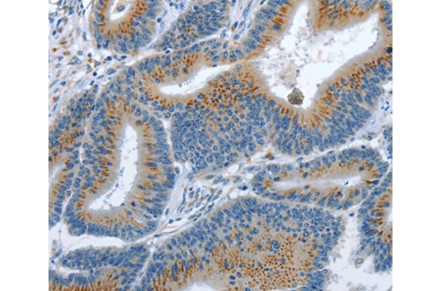 Immunohistochemistry - PFDN6 Antibody from Signalway Antibody (37367) - Antibodies.com