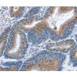 Immunohistochemistry - PFDN6 Antibody from Signalway Antibody (37367) - Antibodies.com
