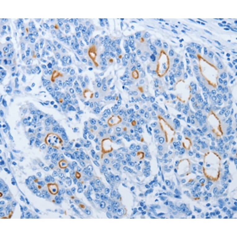 Immunohistochemistry - NEK10 Antibody from Signalway Antibody (37381) - Antibodies.com