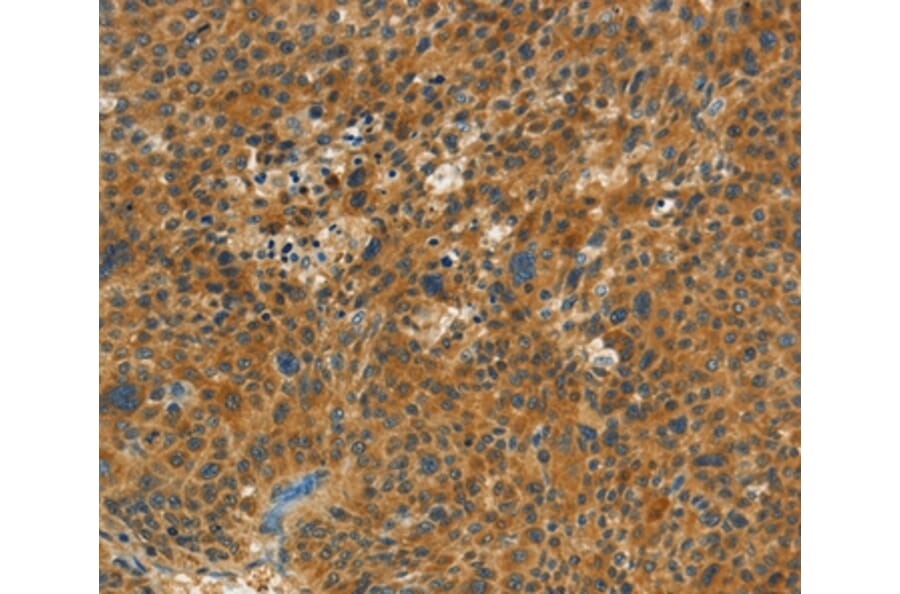 Immunohistochemistry - NPAP1 Antibody from Signalway Antibody (37386) - Antibodies.com