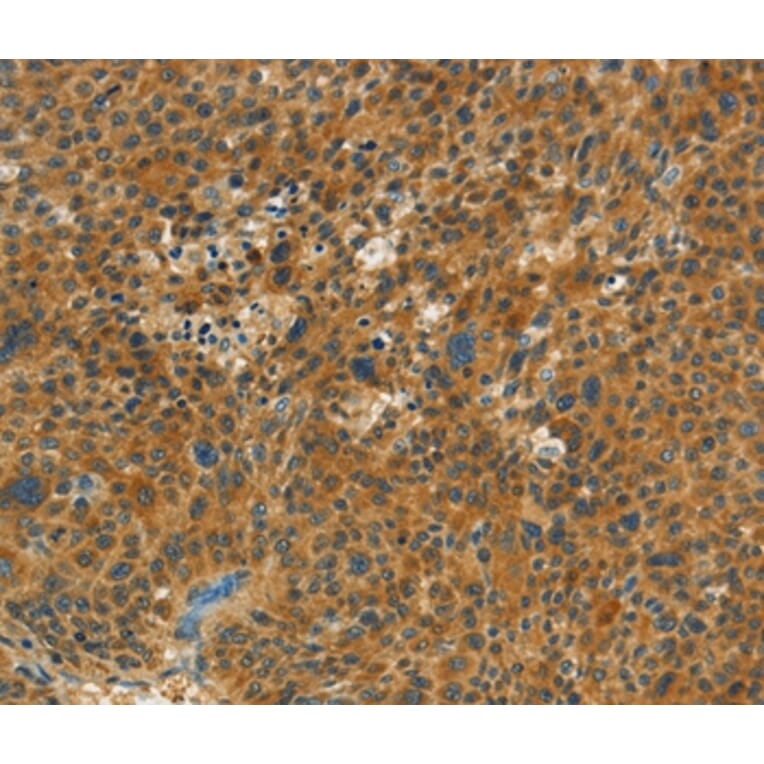 Immunohistochemistry - NPAP1 Antibody from Signalway Antibody (37386) - Antibodies.com