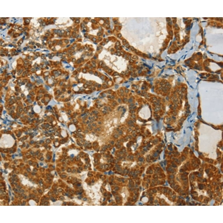 Immunohistochemistry - NPAP1 Antibody from Signalway Antibody (37386) - Antibodies.com