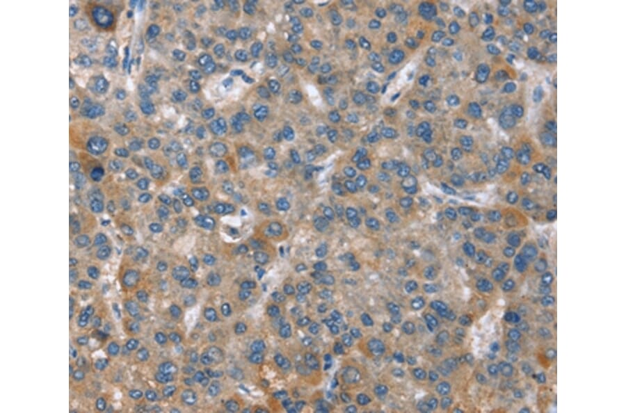 Immunohistochemistry - GINS1 Antibody from Signalway Antibody (37395) - Antibodies.com