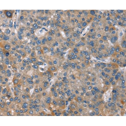 Immunohistochemistry - GINS1 Antibody from Signalway Antibody (37395) - Antibodies.com