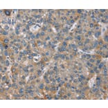 Immunohistochemistry - GINS1 Antibody from Signalway Antibody (37395) - Antibodies.com