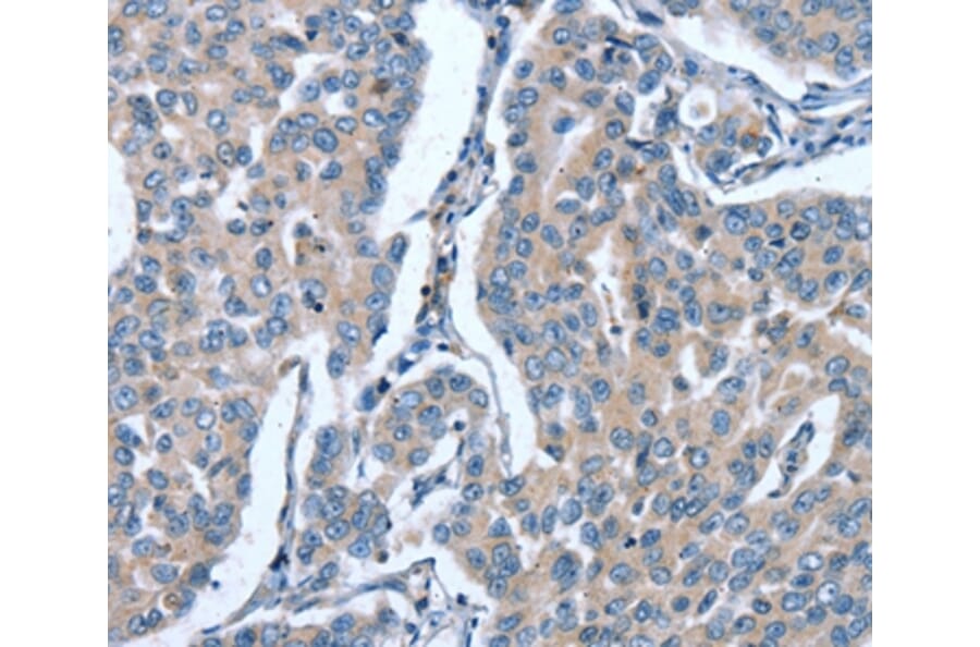 Immunohistochemistry - GINS1 Antibody from Signalway Antibody (37395) - Antibodies.com