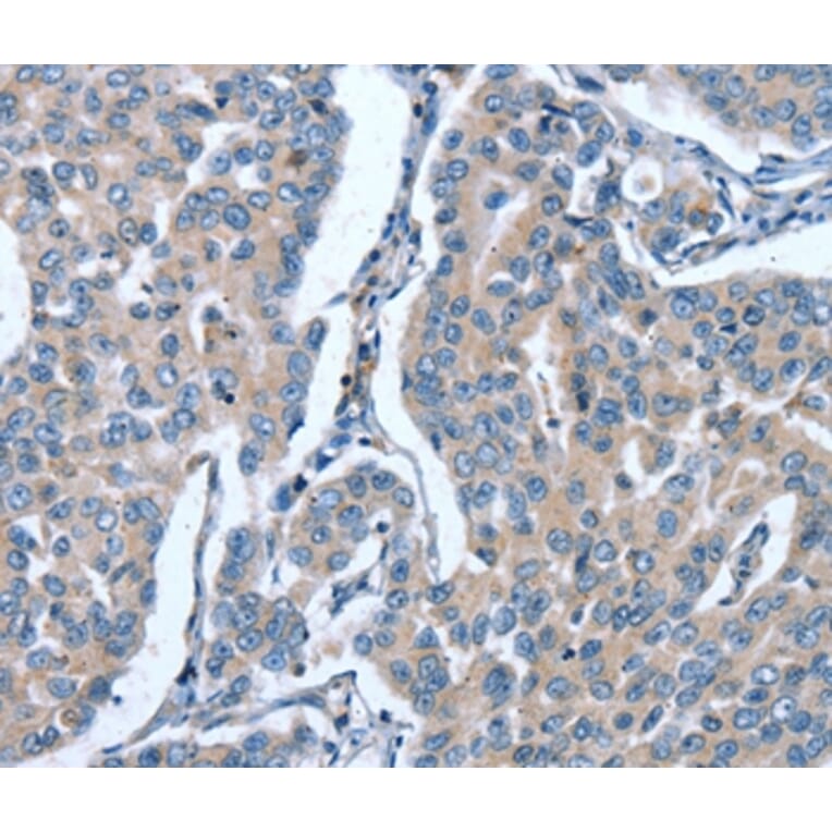 Immunohistochemistry - GINS1 Antibody from Signalway Antibody (37395) - Antibodies.com