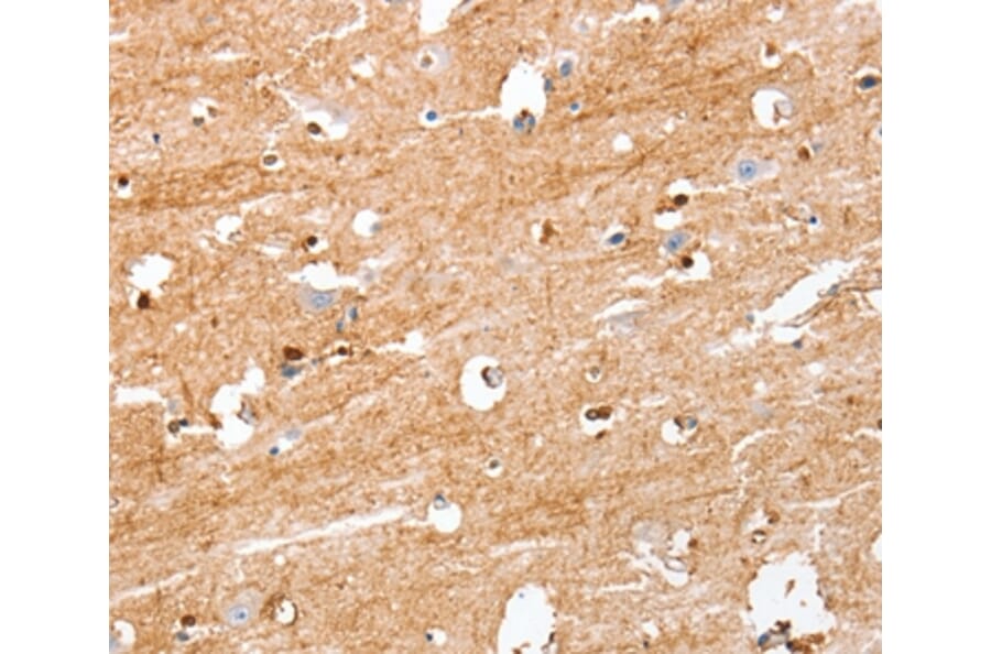 Immunohistochemistry - S100B Antibody from Signalway Antibody (37396) - Antibodies.com