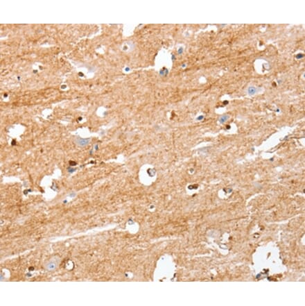 Immunohistochemistry - S100B Antibody from Signalway Antibody (37396) - Antibodies.com