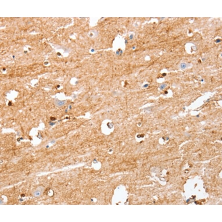 Immunohistochemistry - S100B Antibody from Signalway Antibody (37396) - Antibodies.com