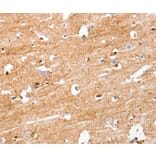 Immunohistochemistry - S100B Antibody from Signalway Antibody (37396) - Antibodies.com