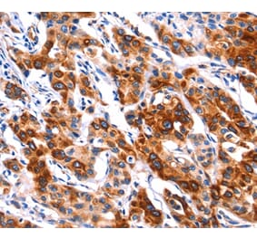 Immunohistochemistry - SEPT4 Antibody from Signalway Antibody (37398) - Antibodies.com