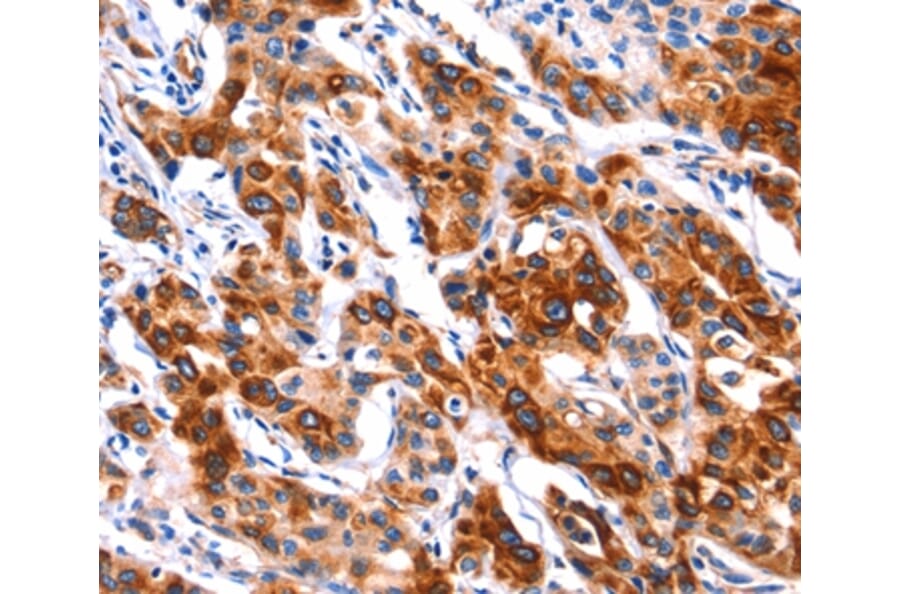 Immunohistochemistry - SEPT4 Antibody from Signalway Antibody (37398) - Antibodies.com