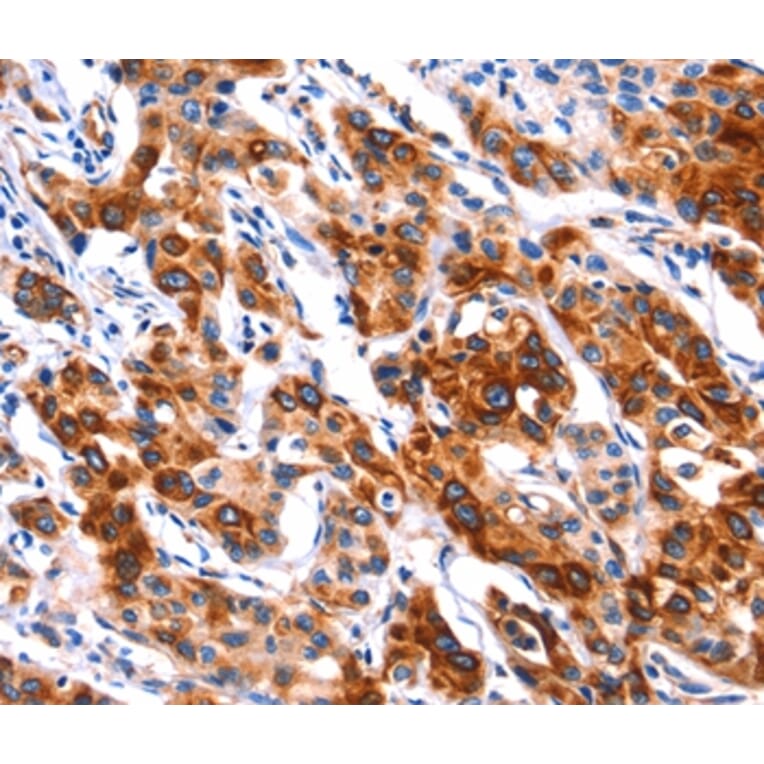 Immunohistochemistry - SEPT4 Antibody from Signalway Antibody (37398) - Antibodies.com