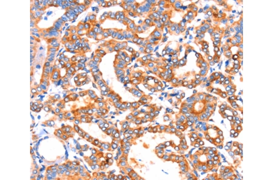 Immunohistochemistry - SEPT4 Antibody from Signalway Antibody (37398) - Antibodies.com