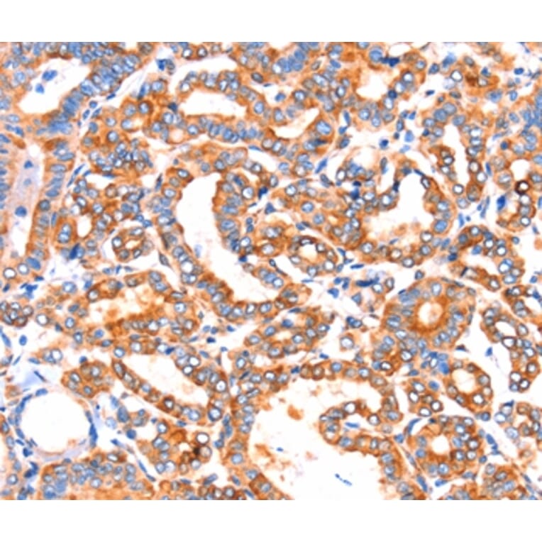 Immunohistochemistry - SEPT4 Antibody from Signalway Antibody (37398) - Antibodies.com